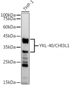 YKL-40/CHI3L1 Rabbit mAb (A20792)