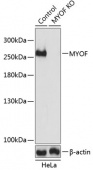 [KO Validated] MYOF Rabbit pAb (A19882)