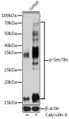 pan Phospho-Serine/Threonine Mouse mAb (AP1067)