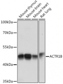 ACTR1B Rabbit pAb (A15773)