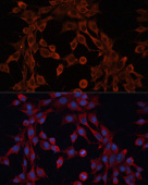 ABCA12 Rabbit pAb (A17680)