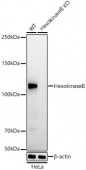 [KO Validated] Hexokinase II Rabbit mAb (A22319)