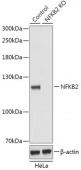 [KO Validated] NF-κB2 Rabbit pAb (A18039)