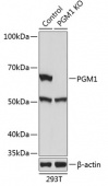 [KO Validated] PGM1 Rabbit pAb (A19904)
