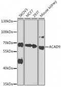 ACAD9 Rabbit pAb (A14121)