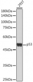 [KO Validated] p53 Rabbit pAb (A21629)