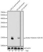 Acetyl-Histone H2A-K5 Rabbit pAb (A15620)