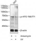 Phospho-ATF2-T69/T71 Rabbit pAb (AP0525)