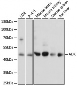 ADK Rabbit pAb (A15023)