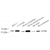 Anti -Acetylcholinesterase Rabbit pAb