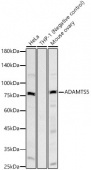 ADAMTS5 Rabbit mAb (A23125)
