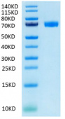 Recombinant Human Mesothelin/MSLN Protein (RP02047)