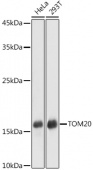 [KD Validated] TOM20 Rabbit pAb (A21723)