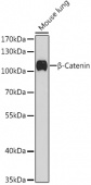 β-Catenin Rabbit pAb (A0316)