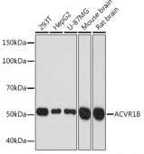 ACVR1B Rabbit mAb (A2279)
