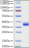 Active Recombinant SARS-COV-2 Spike RBD(L452R, E484Q)  Protein (RP01337)