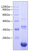 Recombinant Human PDGFA Protein (RP00909)