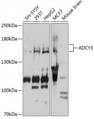 ADCY3 Rabbit pAb (A7870)
