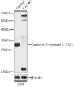 [KO Validated] Carbonic Anhydrase 2 (CA2) Rabbit pAb (A18034)