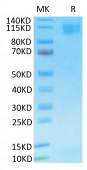 Recombinant SARS-CoV Spike S1 Protein (RP02482)