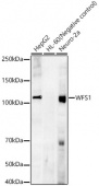 WFS1 Rabbit mAb (A23244)