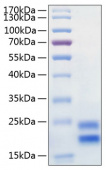 Active Recombinant Human IL-17A/CTLA-8 Protein (RP00212)