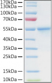 Active Recombinant Human Carbonic anhydrase 9 Protein (RP01428)