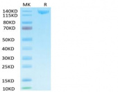 Recombinant SARS-COV-2 Spike S1 Protein (RP02333)