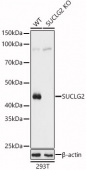 [KO Validated] SUCLG2 Rabbit pAb (A8976)