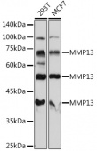 [KO Validated] MMP13 Rabbit pAb (A11755)