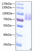 Active Recombinant Human Growth hormone receptor/GHR Protein (RP00251)