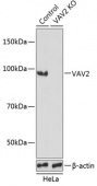 [KO Validated] VAV2 Rabbit pAb (A19883)