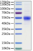 Active Recombinant Human CD19 Protein (RP01307)