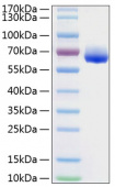 Active Recombinant Human LILRB4/ILT-3/CD85k Protein (RP01155)