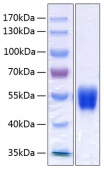 Active Recombinant Human Serpin A1/Alpha-1-antitrypsin Protein (RP00287)
