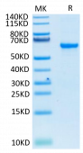 Recombinant SARS-COV-2 Spike RBD  Protein (RP02332)