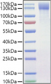 Recombinant Mouse OSMR/IL-31RB Protein (RP01471)