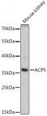 ACP5 Rabbit pAb (A16338)