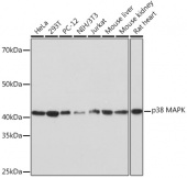 [KO Validated] p38 MAPK Rabbit mAb (A4771)