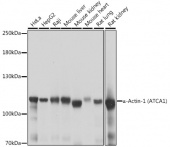 α-Actinin-4 Rabbit pAb (A16310)