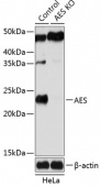 [KO Validated] AES Rabbit pAb (A19944)