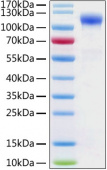 Active Recombinant Human ACE-2 Protein (RP01277)