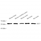 Anti -5HT7 Receptor Rabbit pAb
