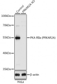 [KO Validated] PKA RIIα (PRKAR2A) Rabbit pAb (A1531)