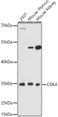 [KO Validated] CDK4 Rabbit pAb (A21317)