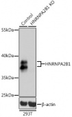[KO Validated] HNRNPA2B1 Rabbit pAb (A1162)