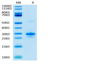 Biotinylated Recombinant Human VEGF-A/VEGF165 Protein (RP02097)