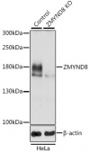 [KO Validated] ZMYND8 Rabbit pAb (A21848)