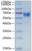 Active Recombinant Human IL-6RA/CD126 Protein (RP00269)