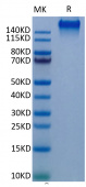Recombinant Human EGFR Protein (RP02347)